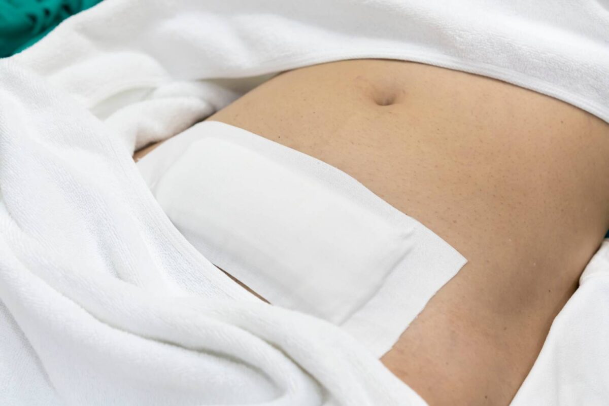 After having Hysterectomy surgery by laparotomic myomectomy