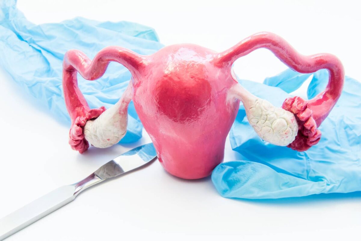 Concept of gynecology surgery